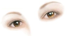 Domubiedri: diabēta vēlīnā komplikācija - retinopātija Bildes